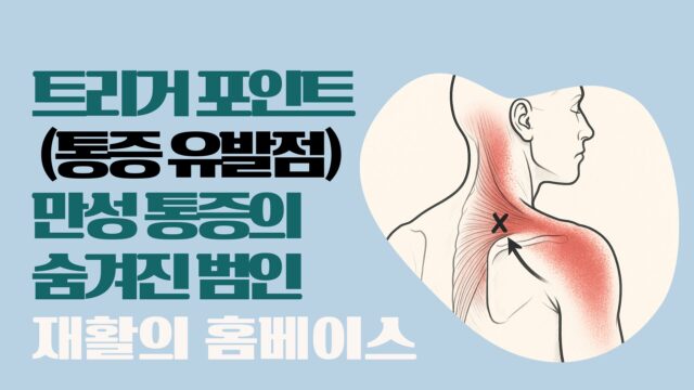 트리거 포인트(통증 유발점), 만성 통증의 숨겨진 범인